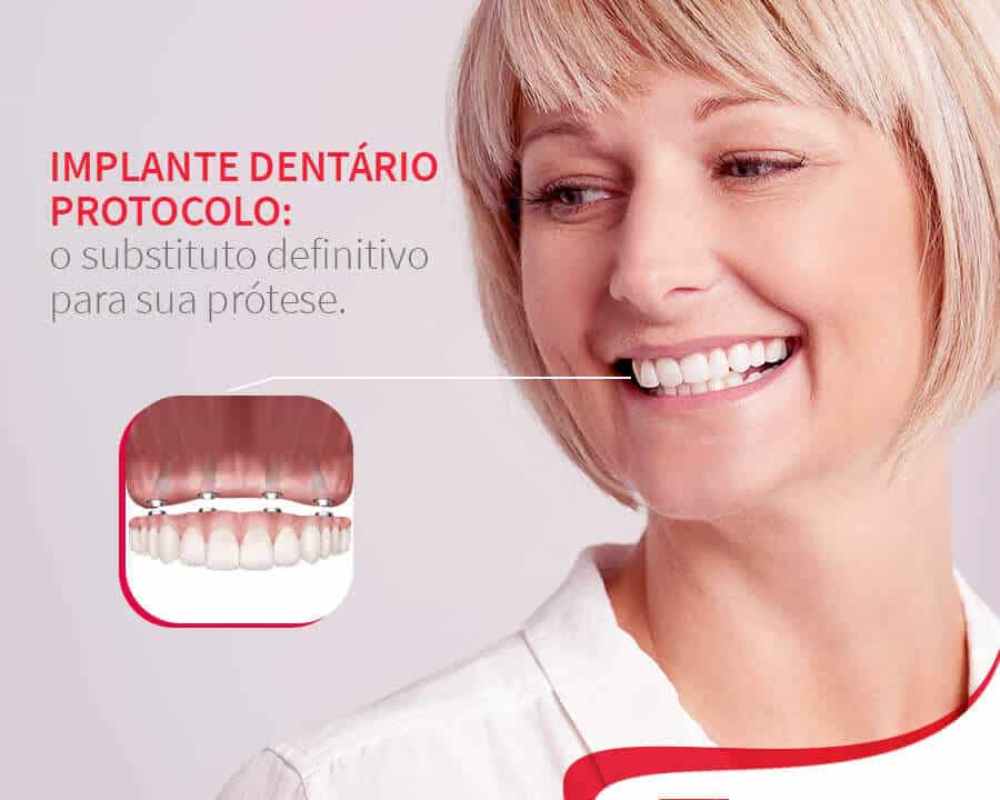 Mulher sorrindo mostrando implante protocolo Post Mídia Digital Dra. Tânia Rodrigues cliente E-clínica Marketing Digital dentista