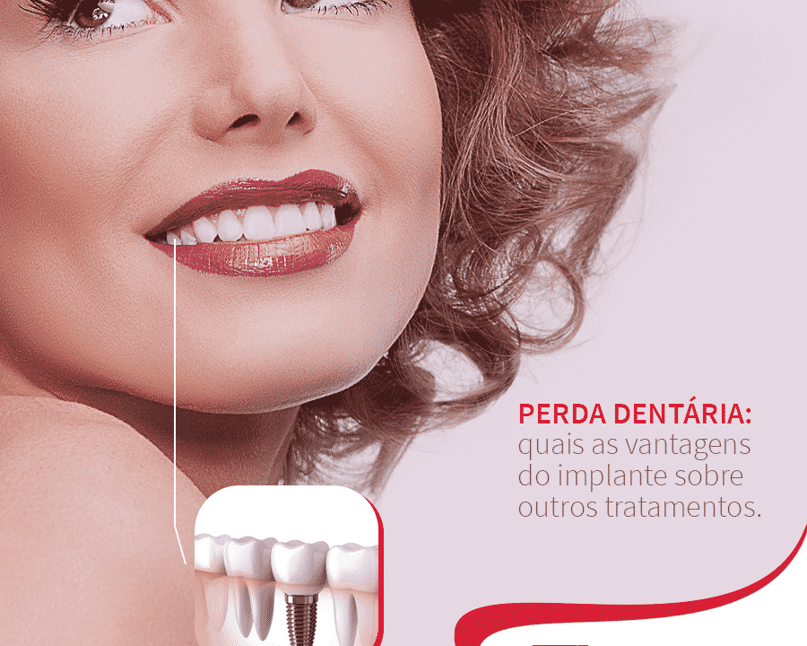 Mulher sorrindo mostrando implante dentário Postagem mídia digital Dra. Tânia Rodrigues Cliente E-clínica Marketing Dentista