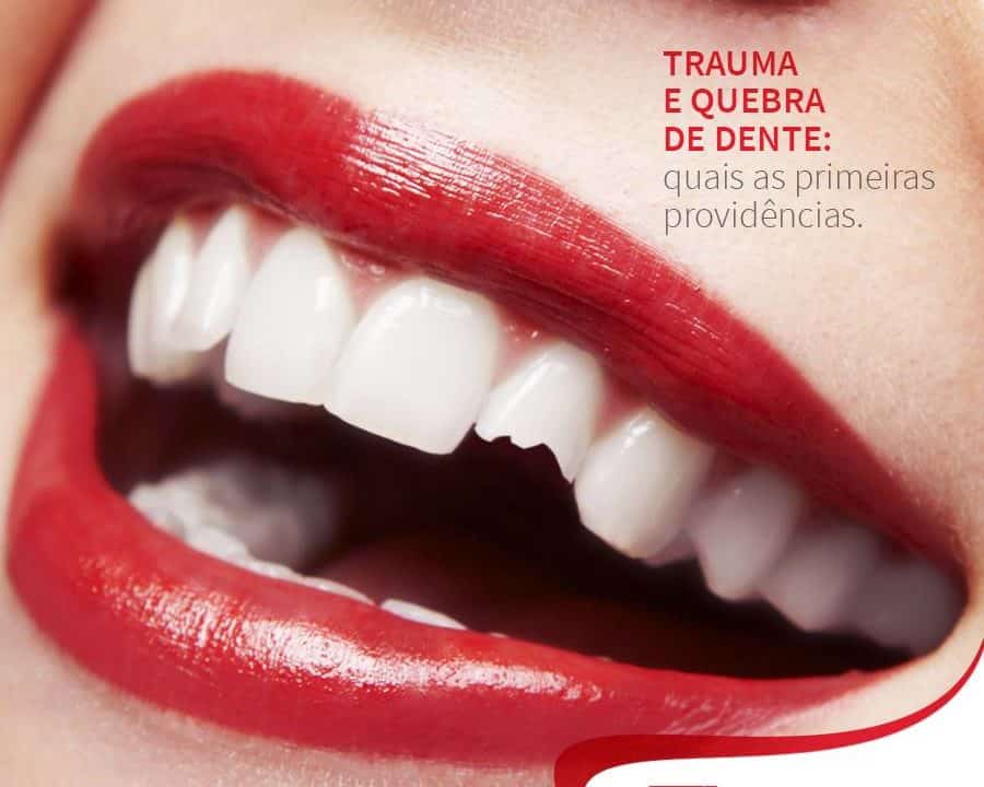 sorriso com dente quebrado Postagem rede social Dra. Tânia Rodrigues cliente E-clínia Marketing dentista