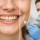 Dentista pode anunciar antes e depois?